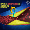Effect Of Fat Deposition on Aorta Flow CFD Simulation, ANSYS Fluent Training