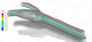 Non-newtonian Blood In Artery CFD Simulation, ANSYS Fluent Training