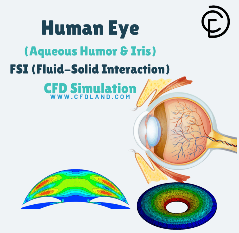 Human Eye (Aqueous Humor and Iris) FSI CFD Simulation