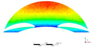 Human Eye (Aqueous Humor and Iris) FSI CFD Simulation