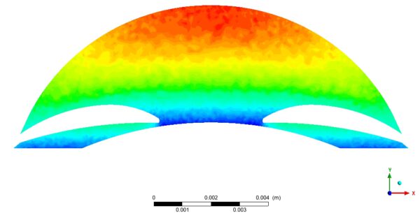 Human Eye (Aqueous Humor and Iris) FSI CFD Simulation