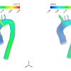 Effect Of Fat Deposition on Aorta Flow CFD Simulation, ANSYS Fluent Training