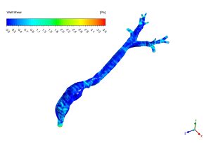 Dry Powder Inhaler In Lungs Using DPM CFD Simulation, ANSYS Fluent Training