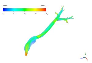 Dry Powder Inhaler In Lungs Using DPM CFD Simulation, ANSYS Fluent Training