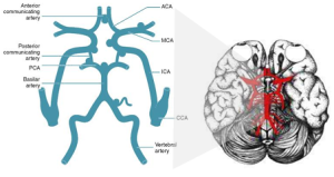 Most common saccular aneurysm sites in Circle of Willis 