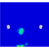 Coronavirus CFD Simulation