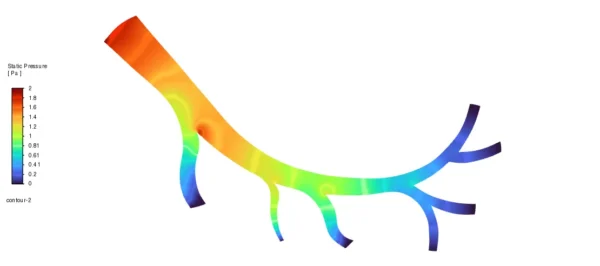 Magnetic Nanoparticles In Artery CFD Simulation using UDF-DPM - ANSYS Fluent Tutorial