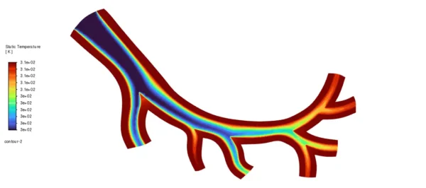 Magnetic Nanoparticles In Artery CFD Simulation using UDF-DPM - ANSYS Fluent Tutorial