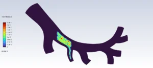Magnetic Nanoparticles In Artery CFD Simulation using UDF-DPM - ANSYS Fluent Tutorial