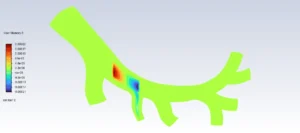 Magnetic Nanoparticles In Artery CFD Simulation using UDF-DPM - ANSYS Fluent Tutorial