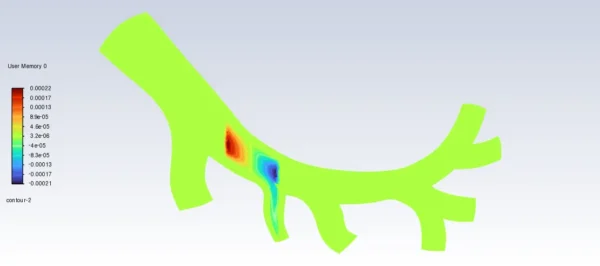 Magnetic Nanoparticles In Artery CFD Simulation using UDF-DPM - ANSYS Fluent Tutorial