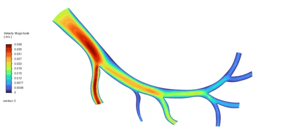 Magnetic Nanoparticles In Artery CFD Simulation using UDF-DPM - ANSYS Fluent Tutorial