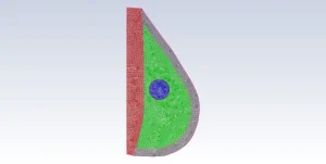 Computational mesh grid of the 2D breast model, displaying the divided computer cells used by the software to calculate the heat transfer exactly