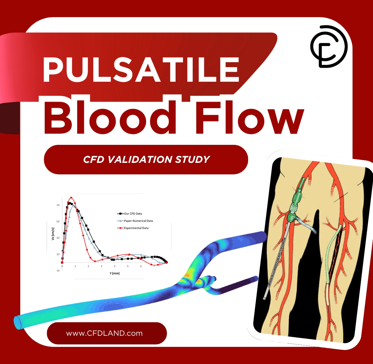 image of Pulsatile Blood Flow CFD Simulation: ANSYS Tutorial Pulsatile Blood Flow CFD Simulation: ANSYS Tutorial