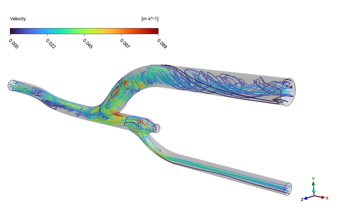 image of Pulsatile Blood Flow CFD Simulation: ANSYS Tutorial Pulsatile Blood Flow CFD Simulation: ANSYS Tutorial - Image 9