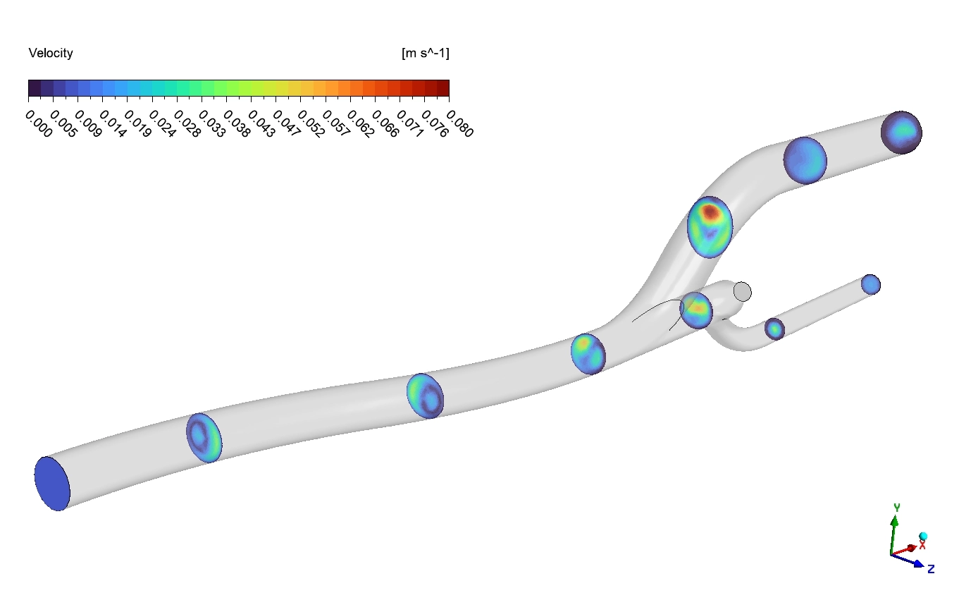 image of Pulsatile Blood Flow CFD Simulation: ANSYS Tutorial Pulsatile Blood Flow CFD Simulation: ANSYS Tutorial - Image 4