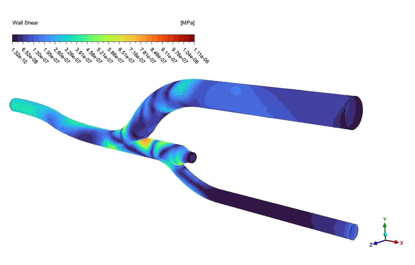 image of Pulsatile Blood Flow CFD Simulation: ANSYS Tutorial Pulsatile Blood Flow CFD Simulation: ANSYS Tutorial - Image 7