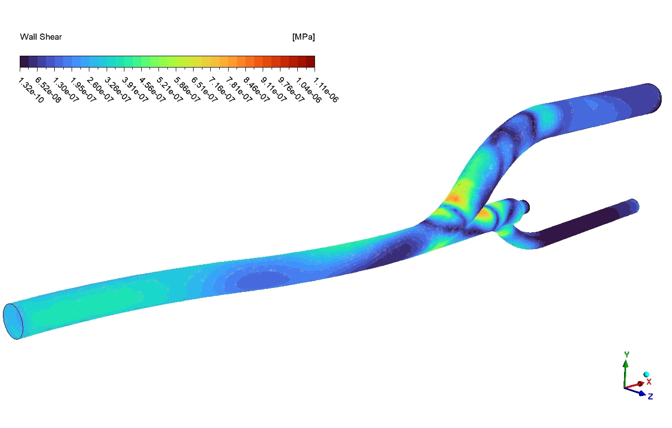 image of Pulsatile Blood Flow CFD Simulation: ANSYS Tutorial Pulsatile Blood Flow CFD Simulation: ANSYS Tutorial - Image 8